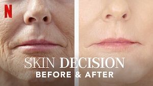 Skin Decision: Before and After 1. Sezon 1. Bölüm (Türkçe Dublaj) izle